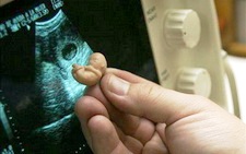 Київ: круглий стіл про законодавчий захист життя від моменту зачаття